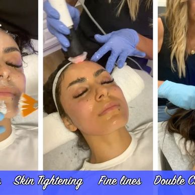 Three-step facial treatment for skin tightening and wrinkle reduction.